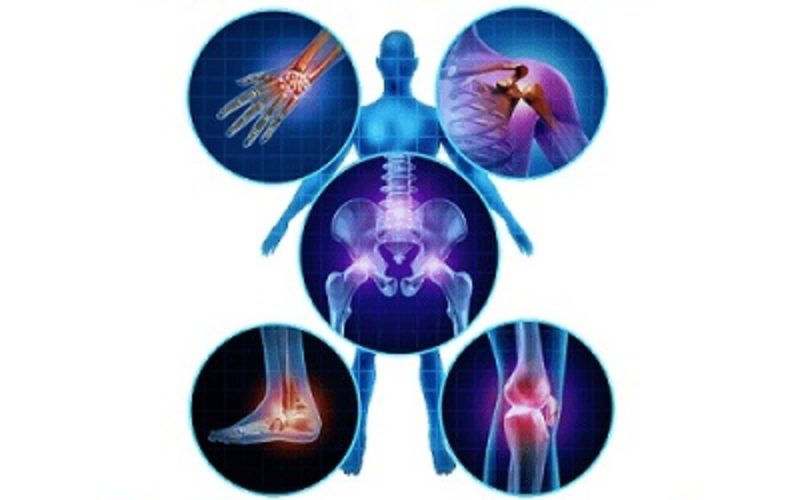 Как удалить остеофиты на коленных суставах- GPIAN