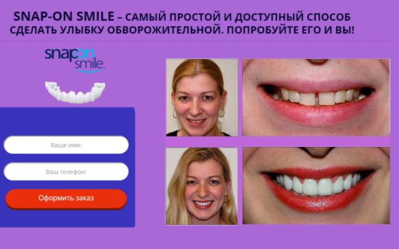 серебряные накладки на зубы