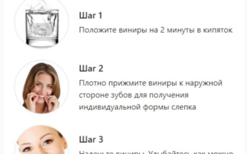 купить виниры нижние зубы