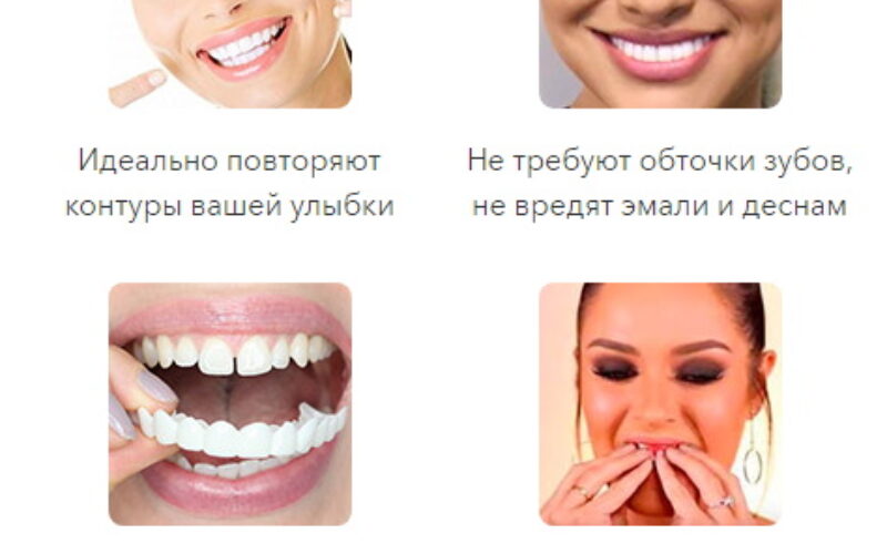 зубные виниры спб